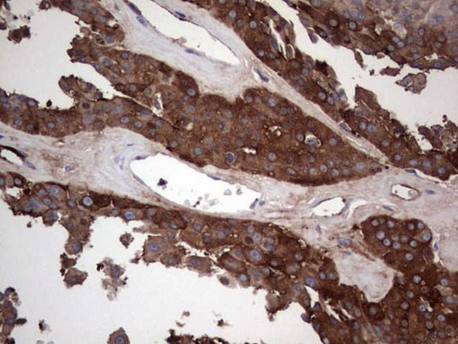 GARS Antibody in Immunohistochemistry (Paraffin) (IHC (P))