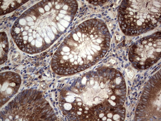 GARS Antibody in Immunohistochemistry (Paraffin) (IHC (P))