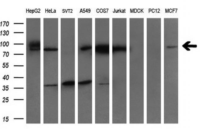 GARS Antibody in Western Blot (WB)