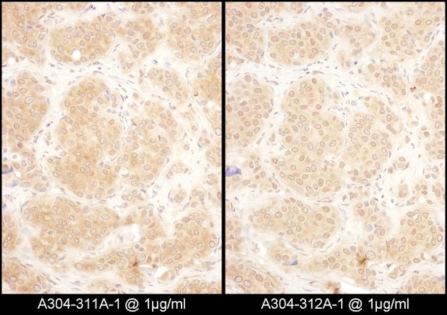 GART Antibody in Immunohistochemistry (IHC)