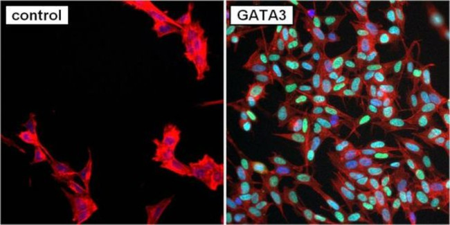 GATA3 Antibody in Immunocytochemistry (ICC/IF)