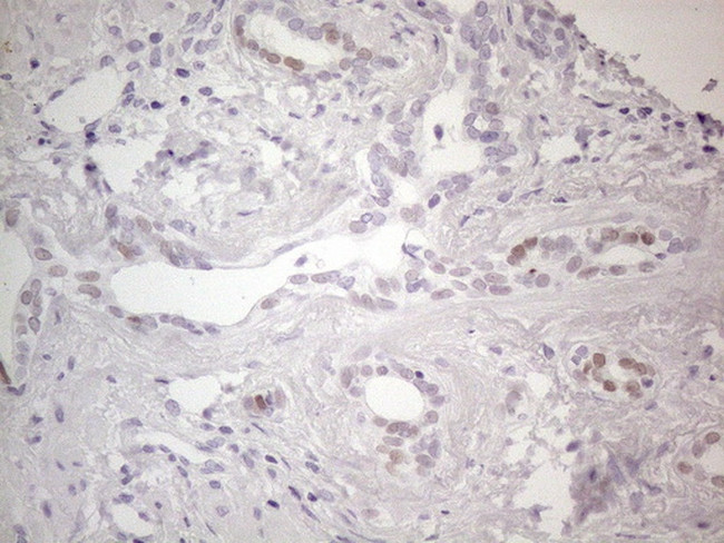 GATA3 Antibody in Immunohistochemistry (Paraffin) (IHC (P))