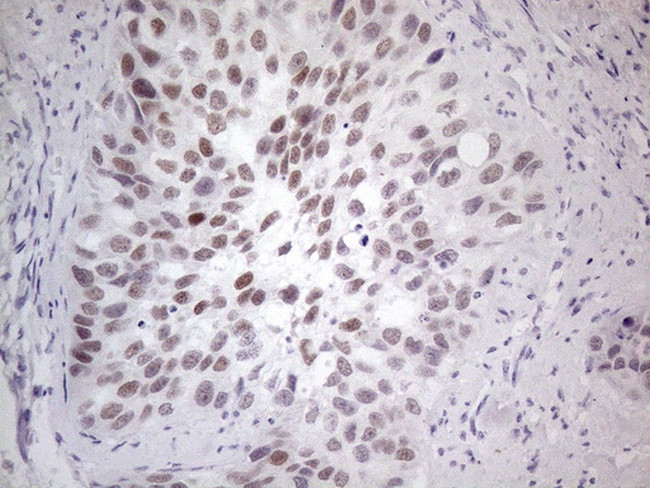 GATA3 Antibody in Immunohistochemistry (Paraffin) (IHC (P))