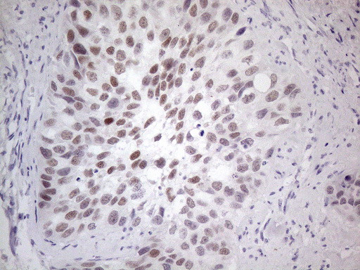 GATA3 Antibody in Immunohistochemistry (Paraffin) (IHC (P))