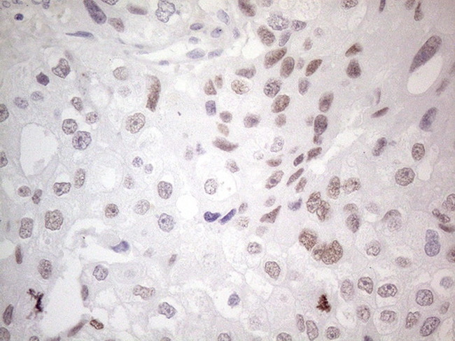 GATA3 Antibody in Immunohistochemistry (Paraffin) (IHC (P))