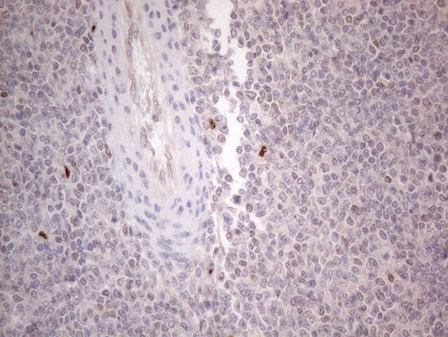 GATA3 Antibody in Immunohistochemistry (Paraffin) (IHC (P))