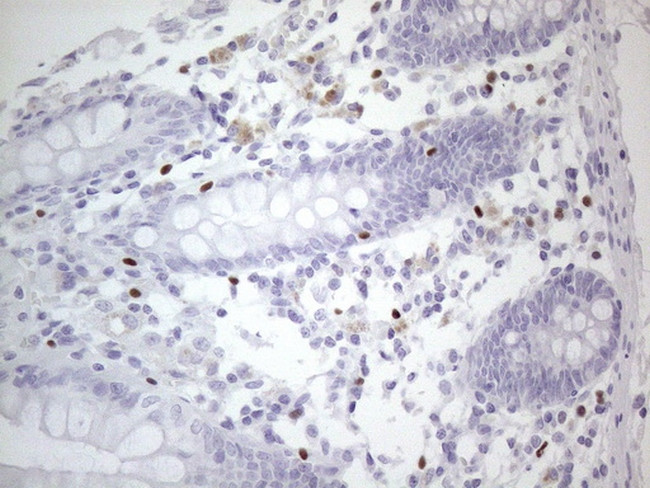 GATA3 Antibody in Immunohistochemistry (Paraffin) (IHC (P))