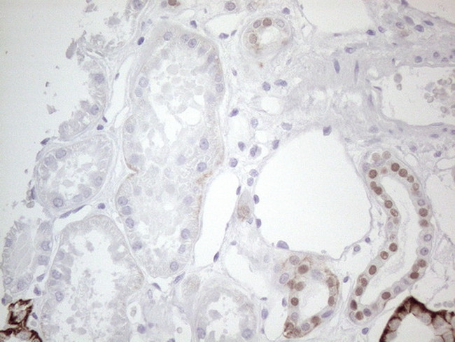 GATA3 Antibody in Immunohistochemistry (Paraffin) (IHC (P))