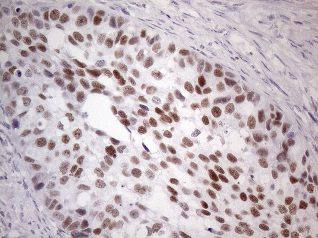 GATA3 Antibody in Immunohistochemistry (Paraffin) (IHC (P))