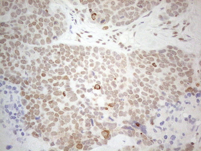 GATA3 Antibody in Immunohistochemistry (Paraffin) (IHC (P))