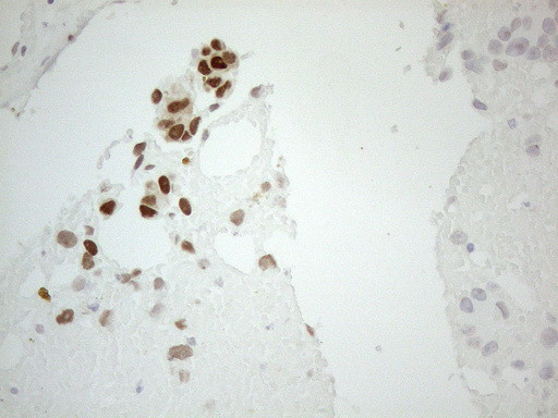 GATA3 Antibody in Immunohistochemistry (Paraffin) (IHC (P))