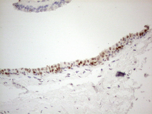 GATA3 Antibody in Immunohistochemistry (Paraffin) (IHC (P))