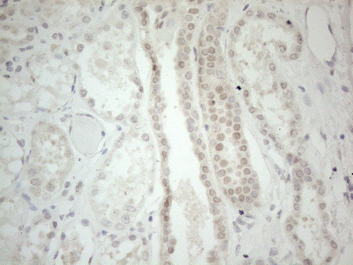 GATA3 Antibody in Immunohistochemistry (Paraffin) (IHC (P))