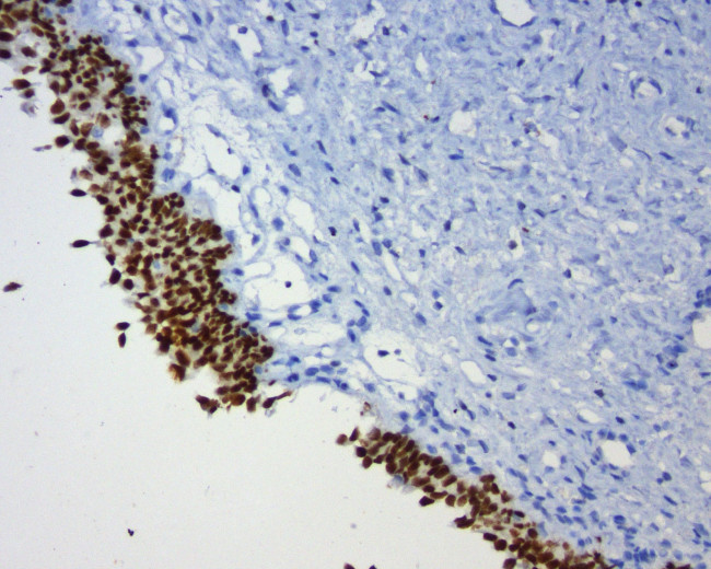 GATA3 Antibody in Immunohistochemistry (Paraffin) (IHC (P))