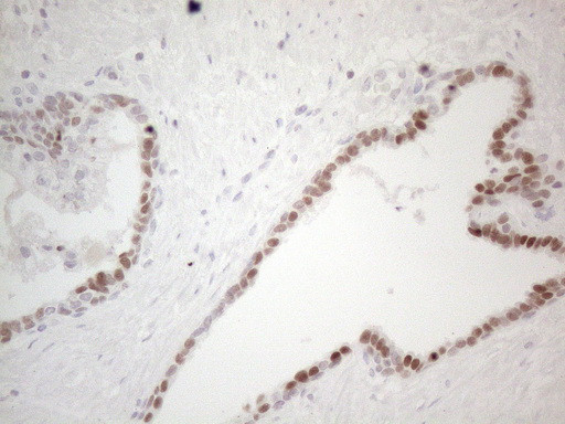 GATA3 Antibody in Immunohistochemistry (Paraffin) (IHC (P))