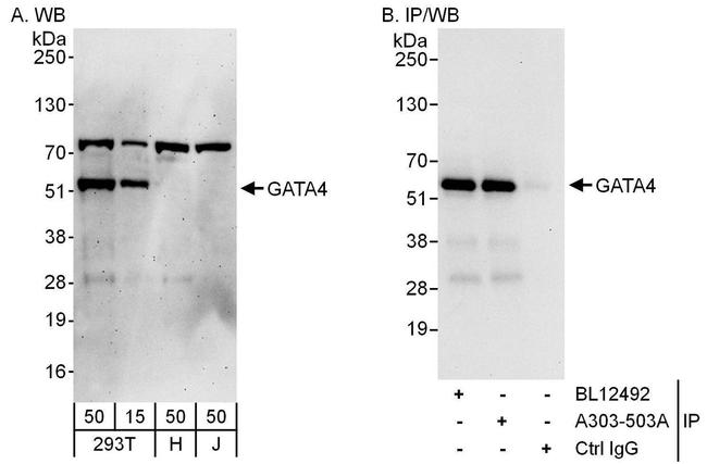 GATA4 Antibody in Western Blot (WB)