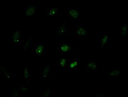 GATA4 Antibody in Immunocytochemistry (ICC/IF)