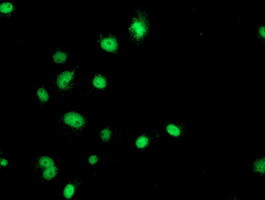 GATM Antibody in Immunocytochemistry (ICC/IF)