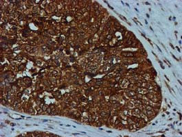 GATM Antibody in Immunohistochemistry (Paraffin) (IHC (P))