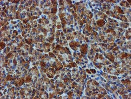 GATM Antibody in Immunohistochemistry (Paraffin) (IHC (P))