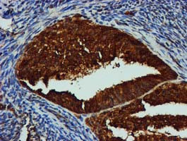 GATM Antibody in Immunohistochemistry (Paraffin) (IHC (P))