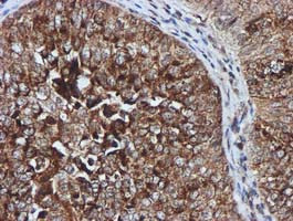 GATM Antibody in Immunohistochemistry (Paraffin) (IHC (P))