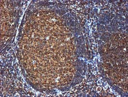 GATM Antibody in Immunohistochemistry (Paraffin) (IHC (P))