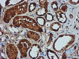 GATM Antibody in Immunohistochemistry (Paraffin) (IHC (P))