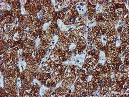 GATM Antibody in Immunohistochemistry (Paraffin) (IHC (P))