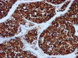 GATM Antibody in Immunohistochemistry (Paraffin) (IHC (P))