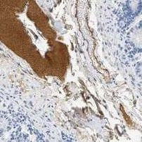 Complement Factor H Antibody in Immunohistochemistry (Paraffin) (IHC (P))