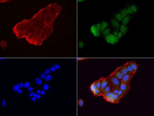 GBA Antibody in Immunocytochemistry (ICC/IF)