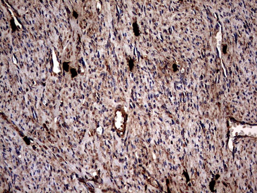 GBA Antibody in Immunohistochemistry (Paraffin) (IHC (P))