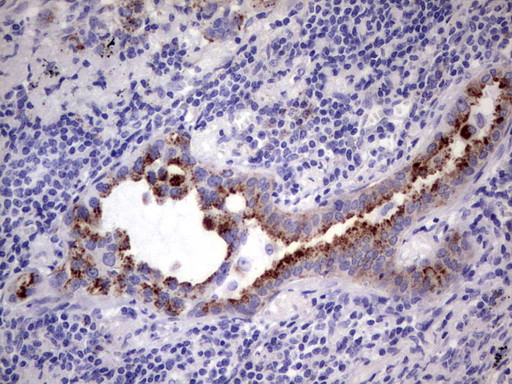 GBA Antibody in Immunohistochemistry (Paraffin) (IHC (P))