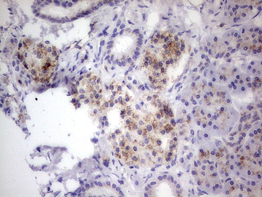 GBA Antibody in Immunohistochemistry (Paraffin) (IHC (P))