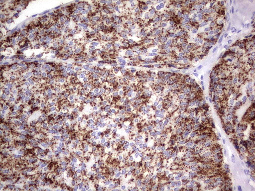 GBA Antibody in Immunohistochemistry (Paraffin) (IHC (P))