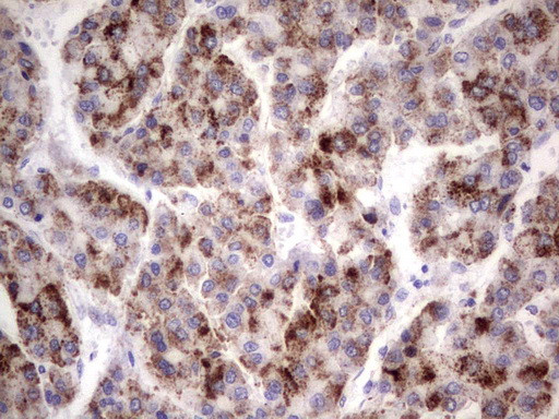 GBA Antibody in Immunohistochemistry (Paraffin) (IHC (P))