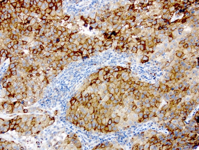 GBA Antibody in Immunohistochemistry (Paraffin) (IHC (P))