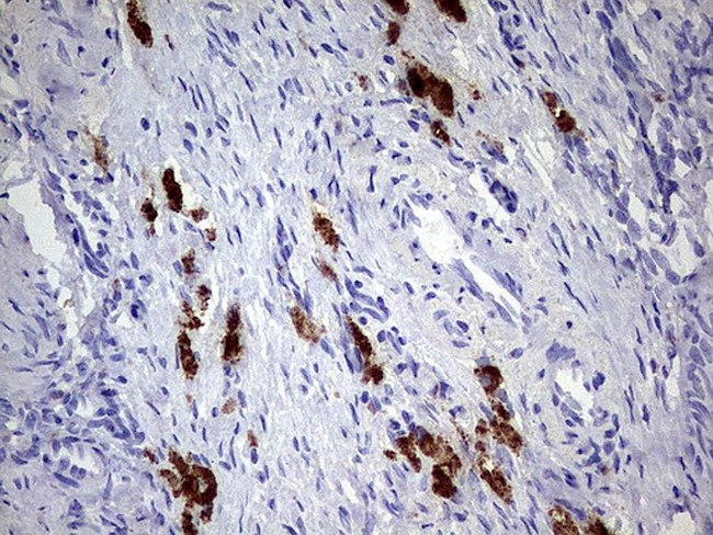 GBA Antibody in Immunohistochemistry (Paraffin) (IHC (P))