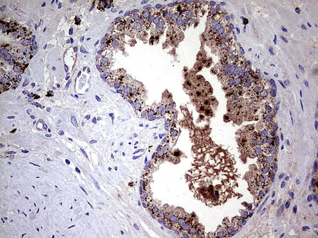 GBA Antibody in Immunohistochemistry (Paraffin) (IHC (P))