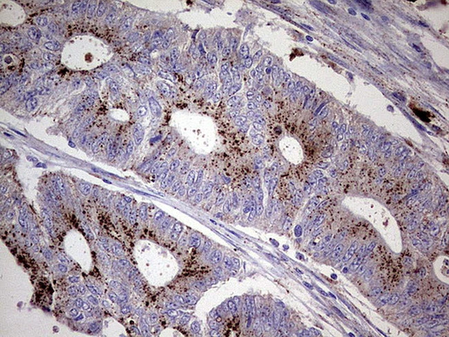 GBA Antibody in Immunohistochemistry (Paraffin) (IHC (P))