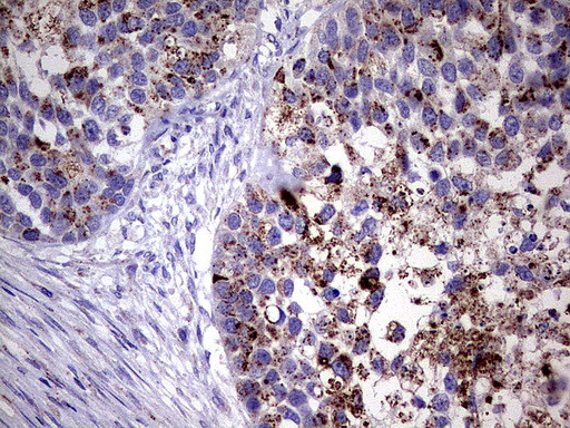 GBA Antibody in Immunohistochemistry (Paraffin) (IHC (P))