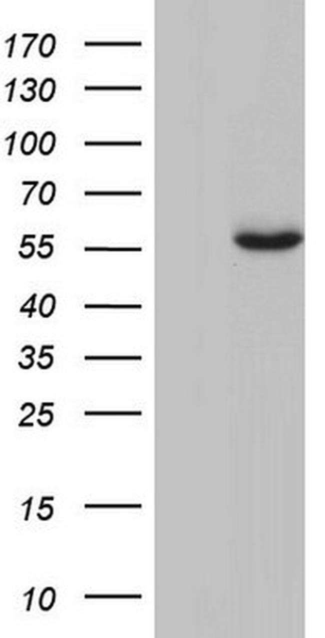 GBA Antibody in Western Blot (WB)