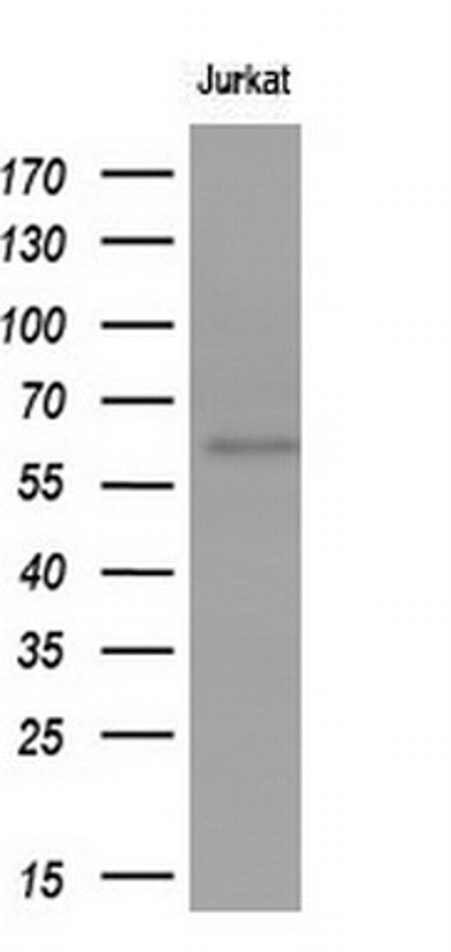 GBA Antibody in Western Blot (WB)