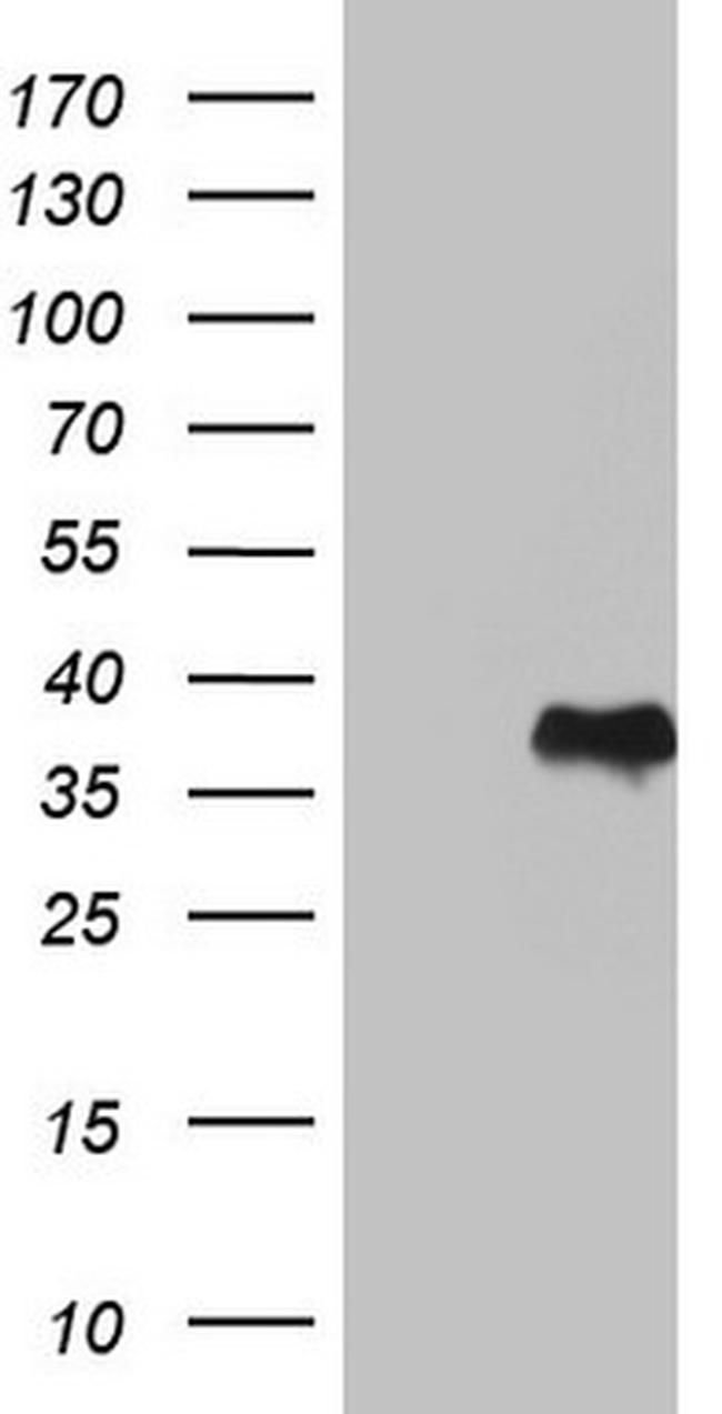 GBA Antibody in Western Blot (WB)