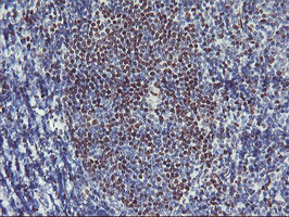 GBA3 Antibody in Immunohistochemistry (Paraffin) (IHC (P))