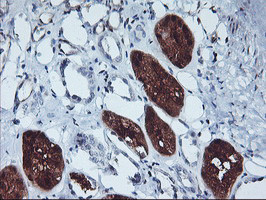 GBA3 Antibody in Immunohistochemistry (Paraffin) (IHC (P))