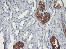 GBA3 Antibody in Immunohistochemistry (Paraffin) (IHC (P))