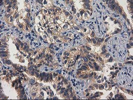 GBA3 Antibody in Immunohistochemistry (Paraffin) (IHC (P))