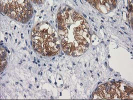 GBA3 Antibody in Immunohistochemistry (Paraffin) (IHC (P))